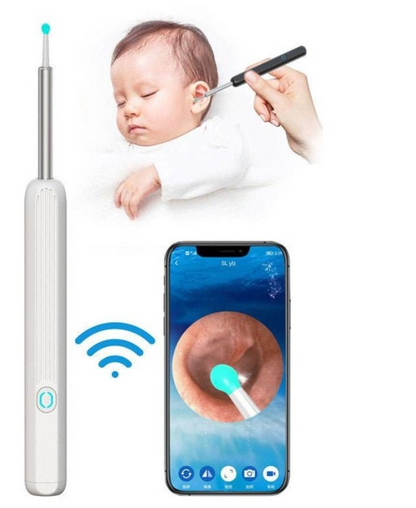 Smart Visual Earwax Removal Kit – HD Wireless Ear Cleaning Tool with Camera