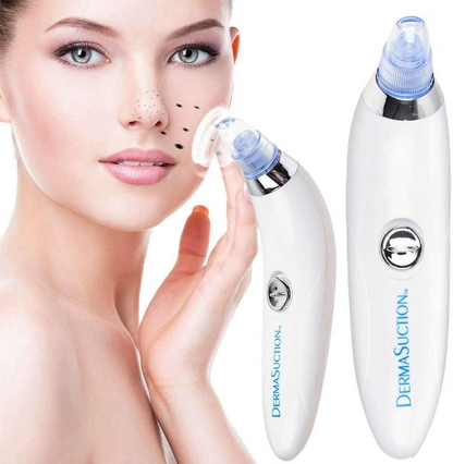 Blackhead Remover Pore Vacuum – USB Rechargeable Facial Cleansing Device with 5 Suction Levels