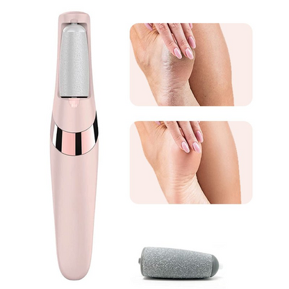 Rechargeable Electric Foot Callus Remover – Professional Pedicure Foot File