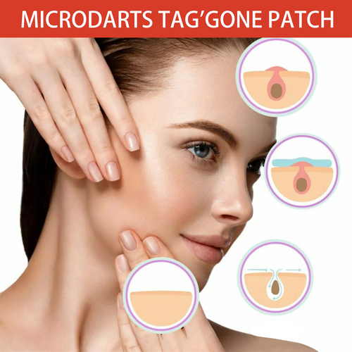 Tea Tree Acne Patch – Invisible Hydrocolloid Spot Patches (144 PCS)